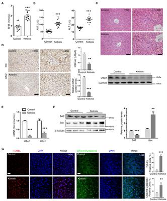 Ufbp1, a Key Player of Ufm1 Conjugation System, Protects Against Ketosis-Induced Liver Injury via Suppressing Smad3 Activation